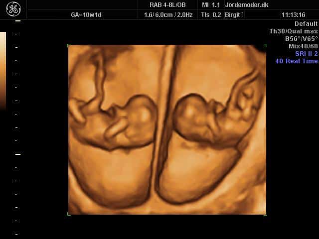3D scanning af baby - Jordemoder.dk - fantastisk oplevelse!